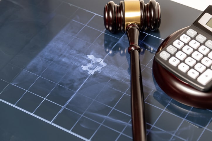 Personal Injury Law in Orange County